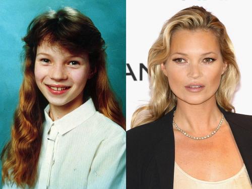 Как из простушки стать красоткой. Из простушки – в красавицу: школьные фото самых знаменитых супермоделей