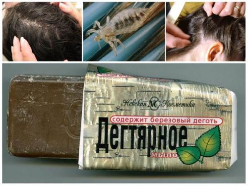 Дегтярное мыло: полезные свойства и возможные опасности 06 Дегтярное мыло: полезные свойства и возможные опасности 06