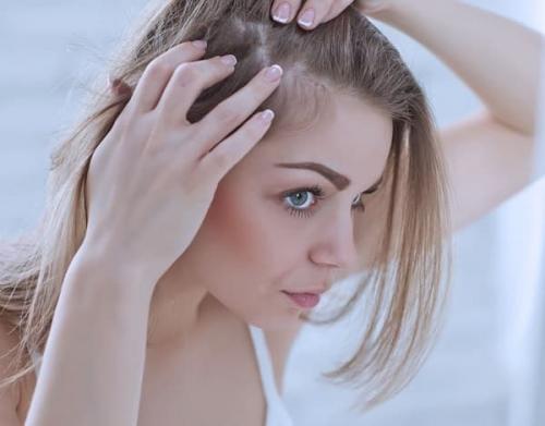 Алопеция у мужчин и женщин. Виды алопеции 03