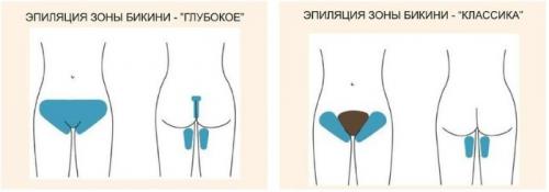 Глубокое бикини чем лучше делать. Суть процедуры эпиляции в зоне глубокого бикини