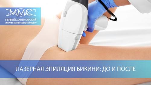 Лазерная эпиляция интимной зоны. День Х –, как происходит эпиляция зоны глубокого бикини 04 Лазерная эпиляция интимной зоны. День Х –, как происходит эпиляция зоны глубокого бикини 04