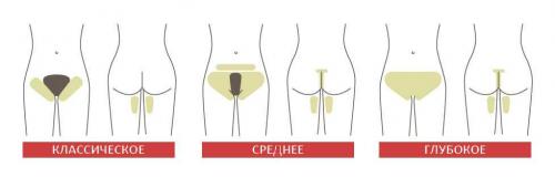 Зона бикини лазерная эпиляция. Особенности удаления волос в интимной зоне