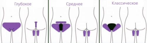 Как убрать волосы с половых губ. Как надолго избавиться от волос при помощи лазера. Общая информация 03