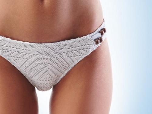 У всех есть волосы вокруг интимной зоны. Гирсутизм - проблема косметологии или опасное расстройство? 05