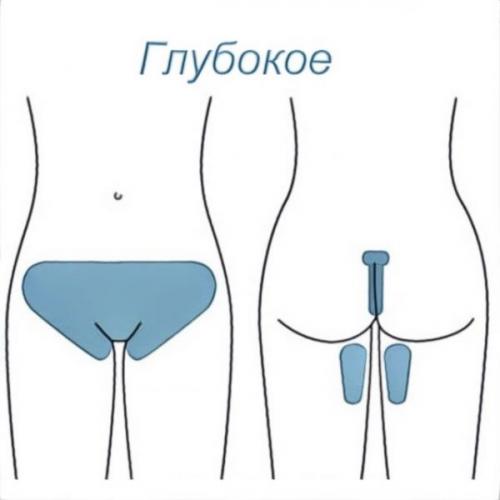 Депиляция бикини дома полосками. Восковые полоски для депиляции зоны бикини