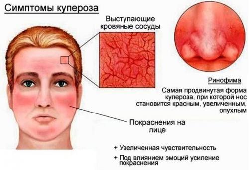 Можно ли хранить маску с медом и яйцом в холодильнике. Маска для лица с медом и яйцом от морщин в домашних условиях