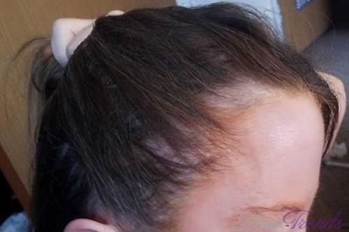 Луковая маска для волос: как приготовить и применять правильно 13 Луковая маска для волос: как приготовить и применять правильно 13