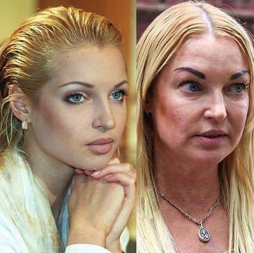 Как сделать прямой пробор, если у вас редкие волосы. Ошибки, которые совершают женщины с редкими волосами