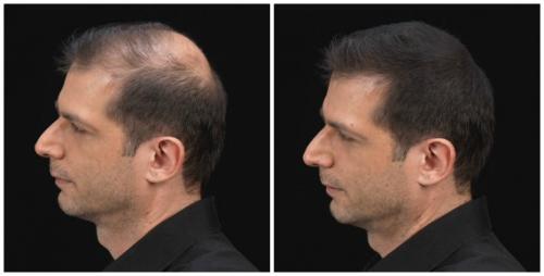 Как сделать идеальный пробор в волосах: пошаговая инструкция 06