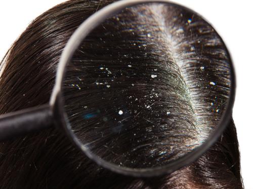 Уход за волосами зимой. Как ухаживать за волосами зимой? 12