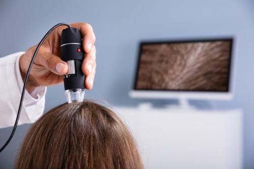 Как определить тип волос у мужчин тест. Первые признаки алопеции у мужчин и женщин