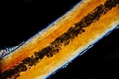 Как увеличить толщину волос на голове. Как увеличить количество волос 07 Как увеличить толщину волос на голове. Как увеличить количество волос 07