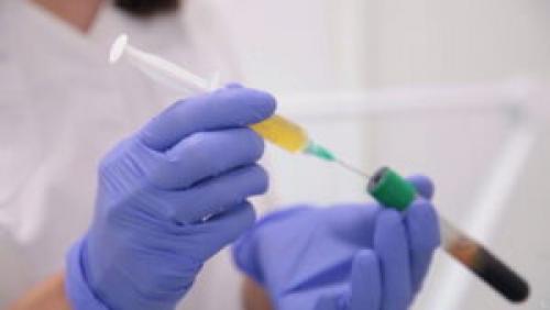 Почему волосы быстро жирнеют и выпадают. Медикаментозное лечение