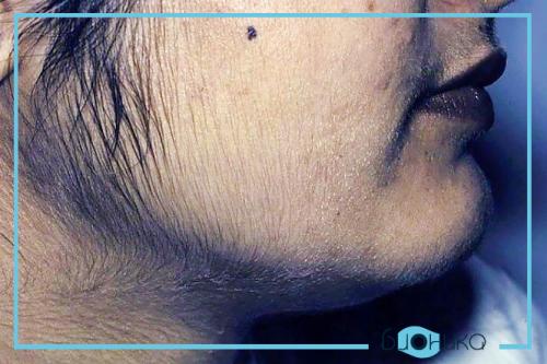 Болезни и аномалии стержней волос. Чем могут быть вызваны болезни волосяного покрова? 09 Болезни и аномалии стержней волос. Чем могут быть вызваны болезни волосяного покрова? 09