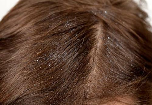 Самое мощное средство для роста волос для мужчин. Как подобрать эффективное средство для поврежденных волос?