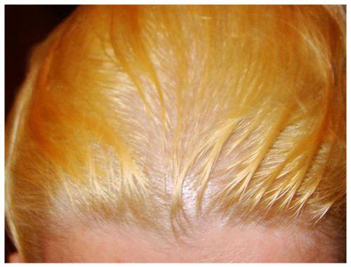 Выход из мелирования без стресса для волос. Восстановление волос после мелирования в домашних условиях 02