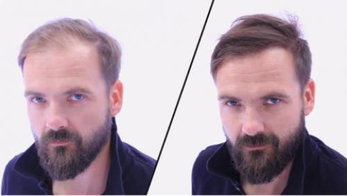 Волосы стали очень редкими, что делать. Причины тонких волос 04 Волосы стали очень редкими, что делать. Причины тонких волос 04