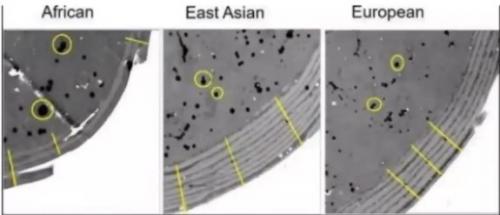 Какие факторы могут вызывать кудрявость волос. 5 причин, по которым кудрявые волосы сухие и ломкие, и что с этим делать