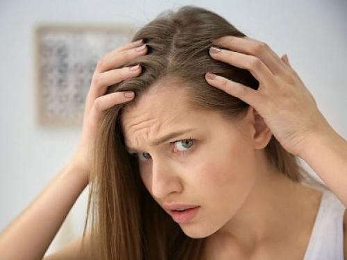 Возрастная алопеция у женщин. Диффузная алопеция у женщин – причины, симптомы и методы лечения 09