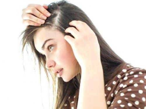 Возрастная алопеция у женщин. Диффузная алопеция у женщин – причины, симптомы и методы лечения 10