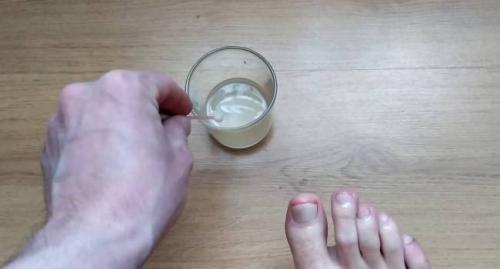 Уксус против перхоти: эффективное и безопасное решение 04