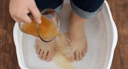 Уксус против перхоти: эффективное и безопасное решение 05