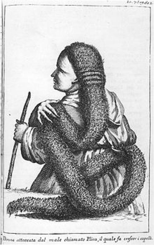 Откуда у человека берутся колтуны и что с ними делать. Колтуны в волосах: причины появления у человека 02