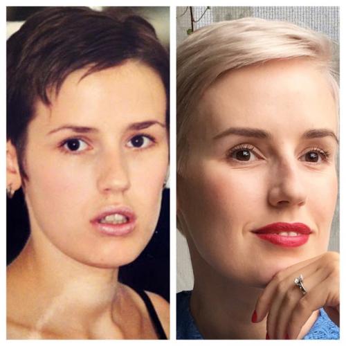 Как часто нужно обновлять стрижку с объемным верхом и затылком. Предыстория