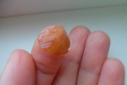 Как правильно выбрать дегтярное мыло для лечения. Полезные свойства дегтярного мыла.