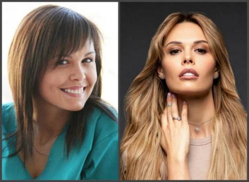 Горбань, хилькевич и другие актрисы, которые зря сделали пластику. 02