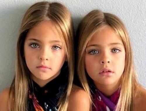 Эти малышки признаны самыми красивыми близнeцами в мирe! 03