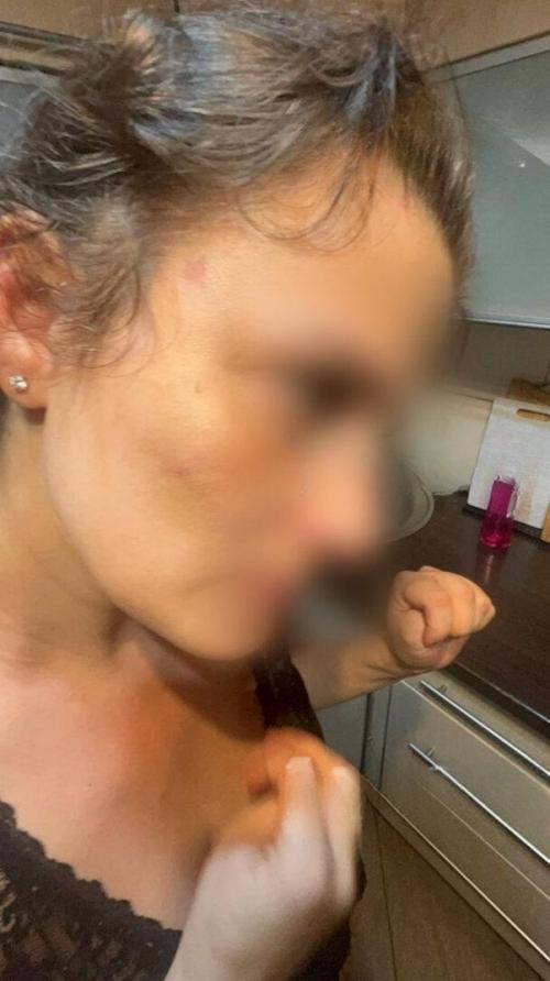 В Калининграде мать троих детей избивает бывший муж, женщина терпит насилие уже несколько лет.