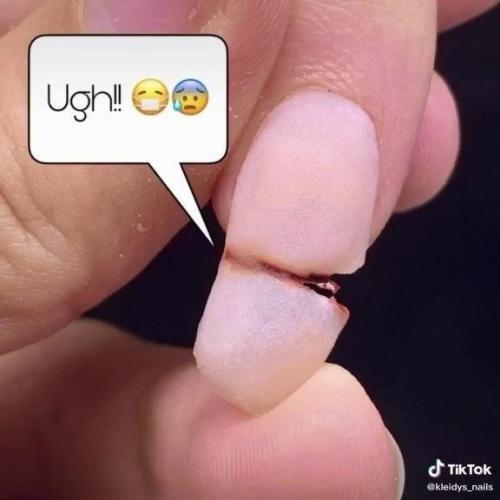 Иногда и такие ногти мастера маникюра могут увидеть! 05