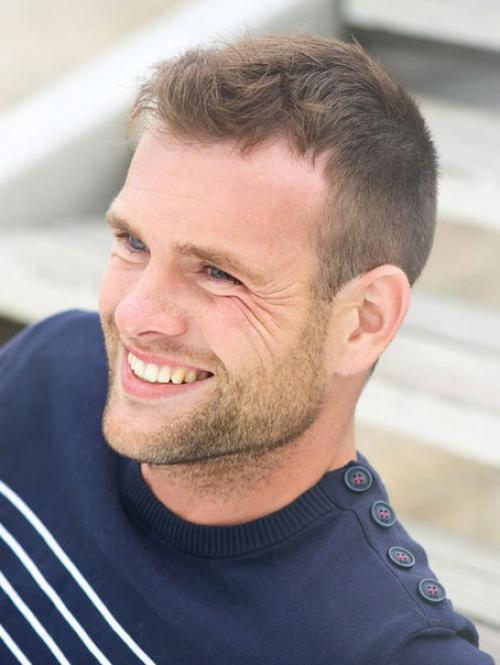 Как скрыть залысины? 05 Как скрыть залысины? 05