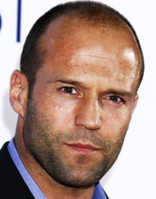 Как скрыть залысины? 03 Как скрыть залысины? 03