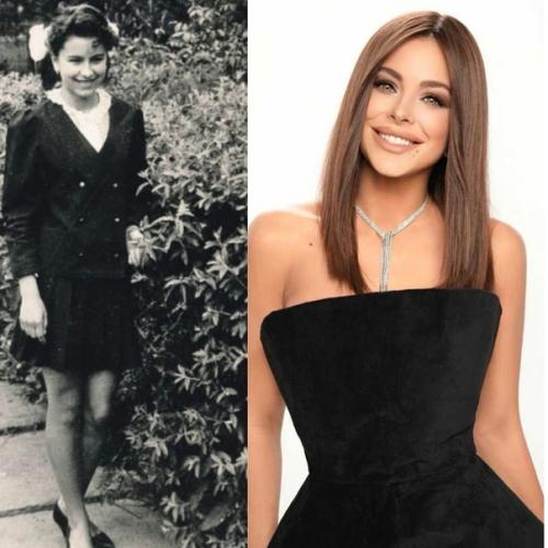 Звёздные фото, которые никто не видел, сильно изменились из-за операций? 02