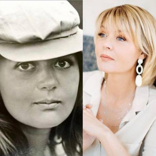 Звёздные фото, которые никто не видел, сильно изменились из-за операций? 04