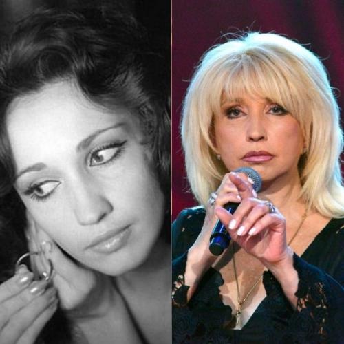 Звёздные фото, которые никто не видел, сильно изменились из-за операций? 03