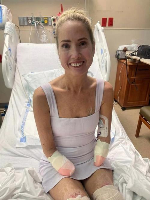 Потеряла все конечности разом. 02 Потеряла все конечности разом. 02