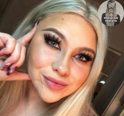 Бедная девочка, тут даже тональник не помогает. 02