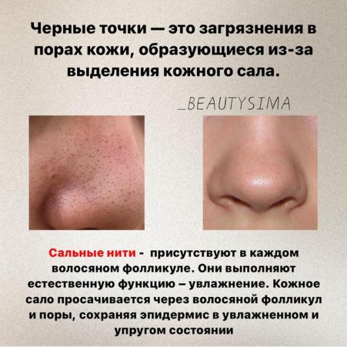 Сальные нити замучили? | Красивые прически