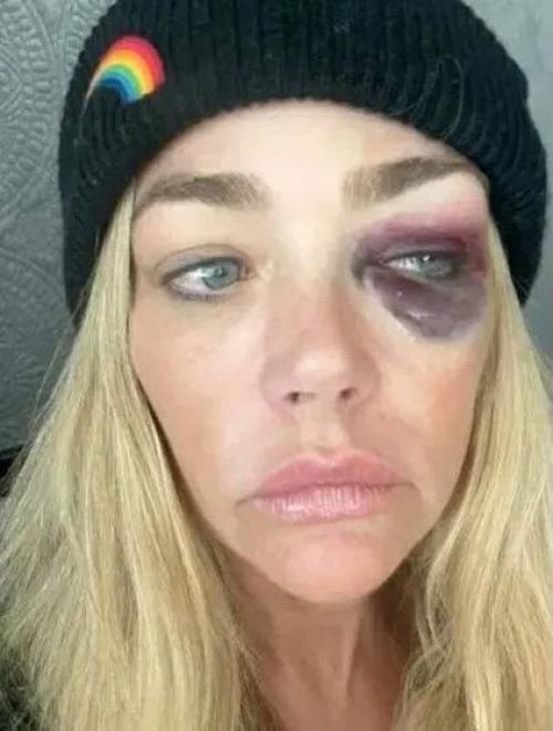 Бывшего мужа дениз Ричардс арестовали по обвинению в домашнем насилии. 01