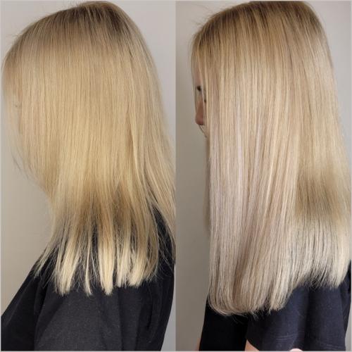 Почему важно решить проблему недостаточного объема волос? 03 Почему важно решить проблему недостаточного объема волос? 03