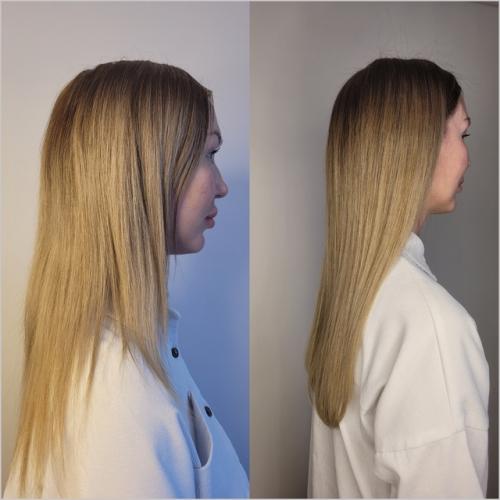 Почему важно решить проблему недостаточного объема волос? 04 Почему важно решить проблему недостаточного объема волос? 04