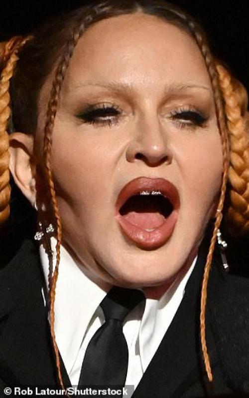 В сети обсуждают неузнаваемую мадонну, которая появилась на церемонии вручения премии Грэмми. 05