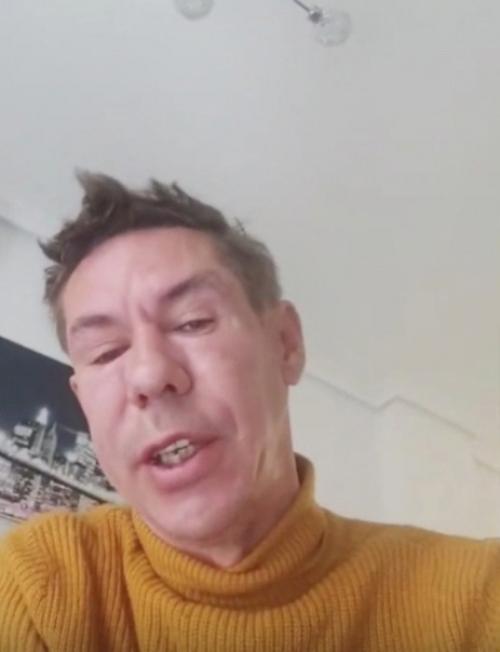 Алексей Панин помолодел на 10 лет после сделанных Уколов Красоты. 02