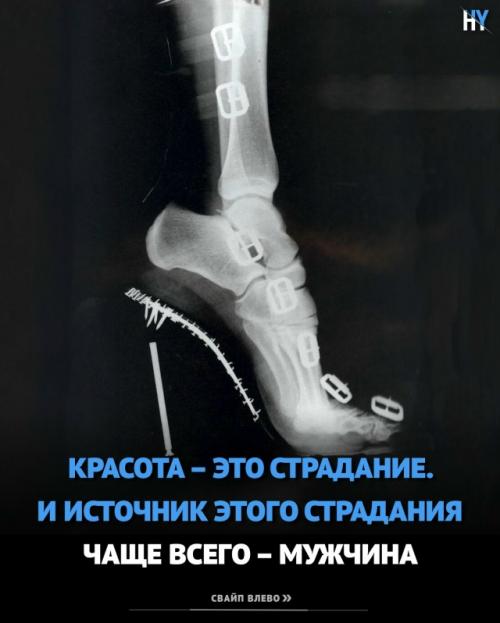 Красота - это боль.  