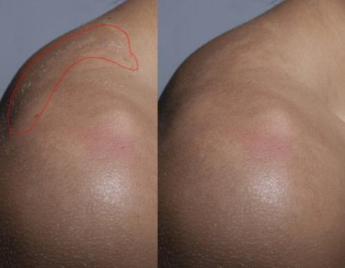 Ретушь студийного портрета. 02 Ретушь студийного портрета. 02