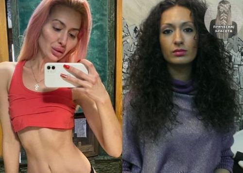 Девушка решила стать красивее и увеличила скулы. 01