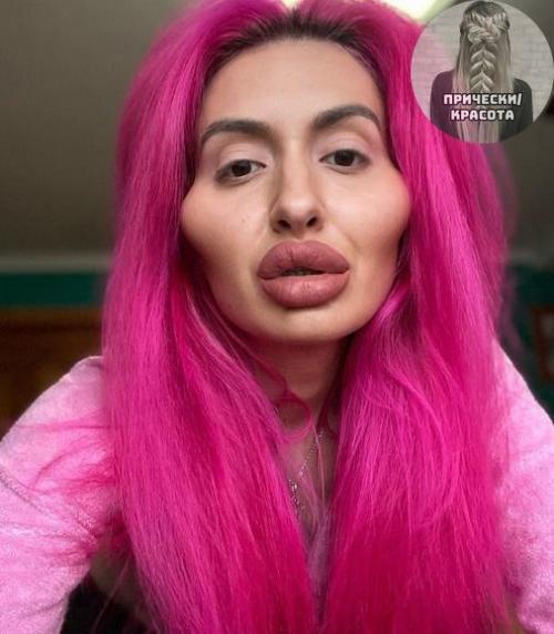 Девушка решила стать красивее и увеличила скулы. 02